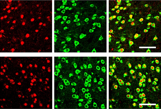 Confocal image of tagged medium spiny neurons in red and green